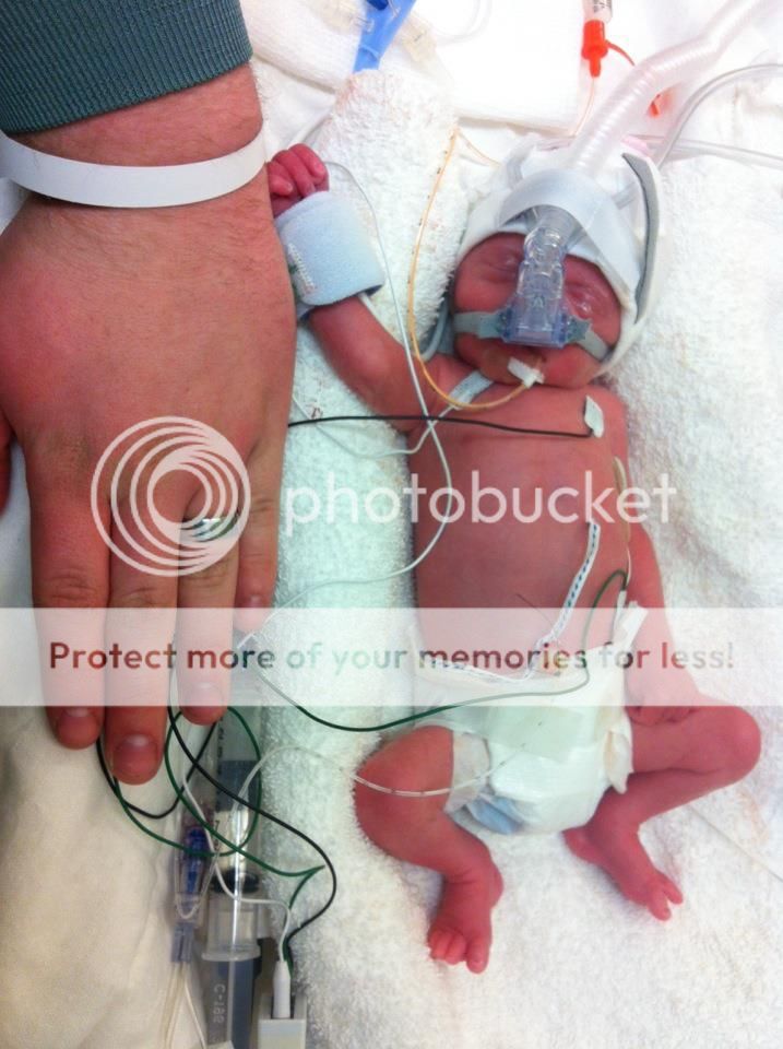 28 week old preemie stories - Page 2 - BabyCenter